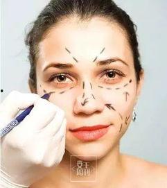 爆料整形诱导案例最新,最新案例警示录 第3张 爆料整形诱导案例最新,最新案例警示录 第3张